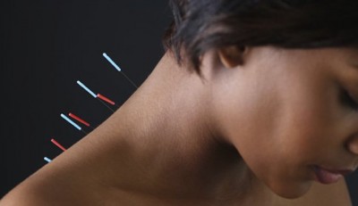 acupuncture-neck-628x363